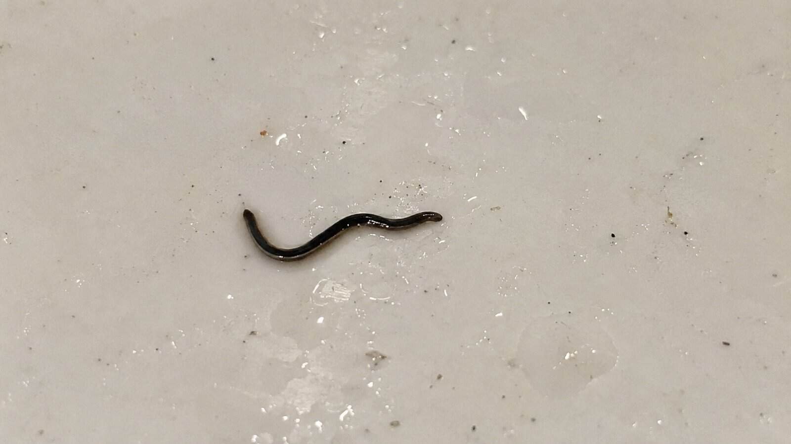 Very Small Black Parasitic Worm: Causes, Symptoms, Identification ...